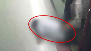 [단독] 백내장 수술 받고 돌연 사망&hellip;"병원은 사과도 없었다"