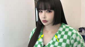 [SBS Star] Fans Notice Park Bom Has the Same Patches on Her Collarbones for 3 Months; Agency Responds