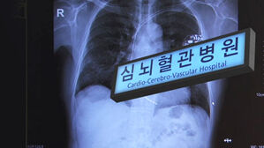 심근경색&middot;뇌졸중, 남성이 더 많이 발생&hellip;사망률은 여성이 높아