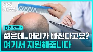 [D리포트] "청년층 탈모 치료비 줍니다" 사회적 질병 vs 혈세 낭비