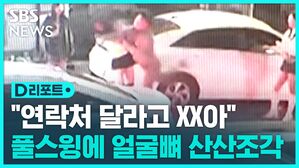 [D리포트] '풀스윙'에 얼굴 골절&hellip;"꽁초 먼저 던졌다" VS "길에 던졌다"