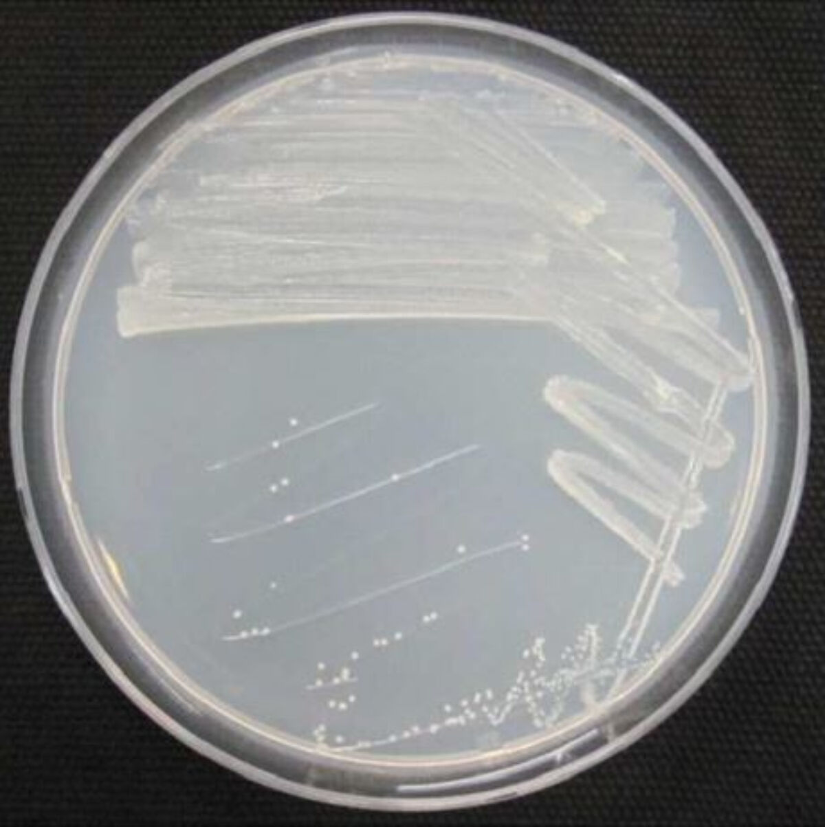 피그멘티파가 쿨라이(Pigmentiphaga kullae) 균주(사진= 안정성평가연구소)
