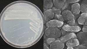 피그멘티파가 쿨라이(Pigmentiphaga kullae) 균주(사진= 안정성평가연구소)