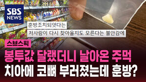 봉투값 달랬더니 날아온 주먹 치아에 코뼈 부러졌는데 훈방?