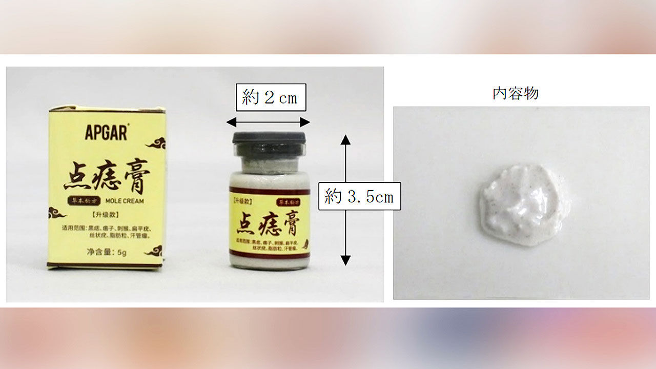 실시간e뉴스 3. 점 빼려다..