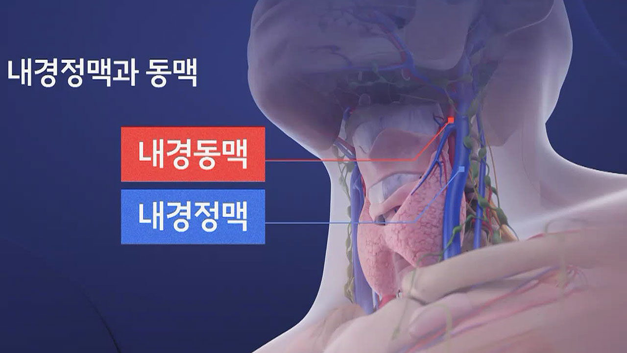 내경정맥, 동맥