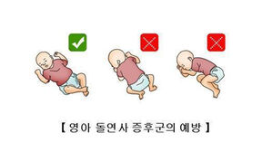 "수면 중 경련 발작, 유아 돌연사 잠재적 원인일 가능성"