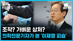 SBS NEWS 뽀얀거탑 조작? 가벼운 상처? 의학전문기자가 본 '이재명 피습'