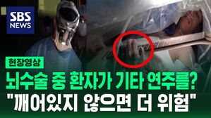 [영상] '뇌 수술' 받는 환자가 수술 도중 기타 연주를 한다면? "깨어 있지 않으면 훨씬 더 위험해져"
