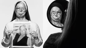 황산테러 생존자 패트리샤 르프랑 화보 (사진= A.S.T.i(Acid Survivors Trust International) 홈페이지)