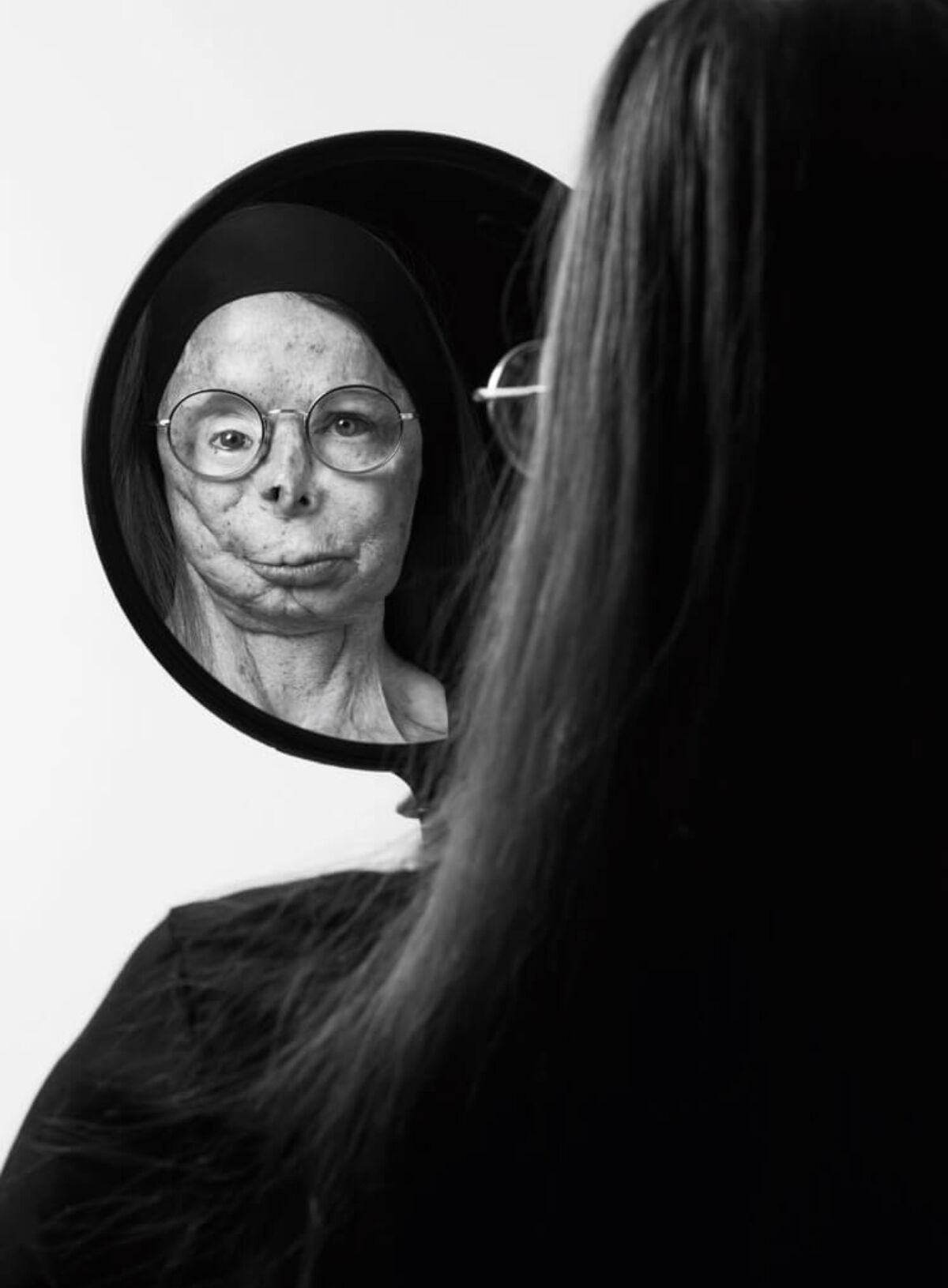 황산테러 생존자 패트리샤 르프랑 화보 (사진= A.S.T.i(Acid Survivors Trust International) 홈페이지)