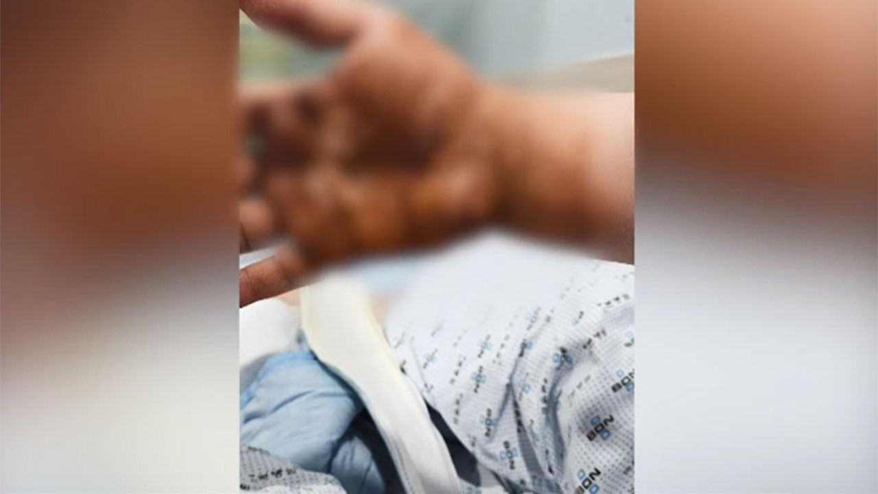 맹견에 공격 당한 대리기사 사연