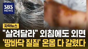 [자막뉴스] 입마개, 목줄도 없었다&hellip;된통 당한 대리기사 부부