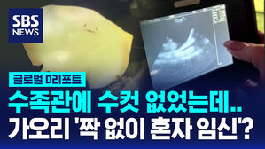 [글로벌D리포트] 미, 가오리 '짝 없이 혼자 임신'?