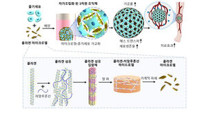 KIST, 중증 하지 허혈로 인한 다리 절단 막는 줄기세포 치료제 개발