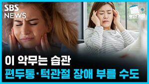 SBS NEWS 뽀얀거탑 이 악무는 습관, 편두통&middot;턱관절 장애 부를 수도