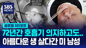 [글로벌D리포트] 72년간 '아이언렁' 호흡기 의지한 美 남성 별세