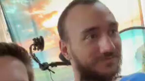 뇌에 머스크표 칩&hellip;전신마비 환자 "불가능한 일 일어났다"