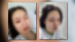 전 연인 폭행 치료받던 20대 사망&hellip;가해자는 불구속