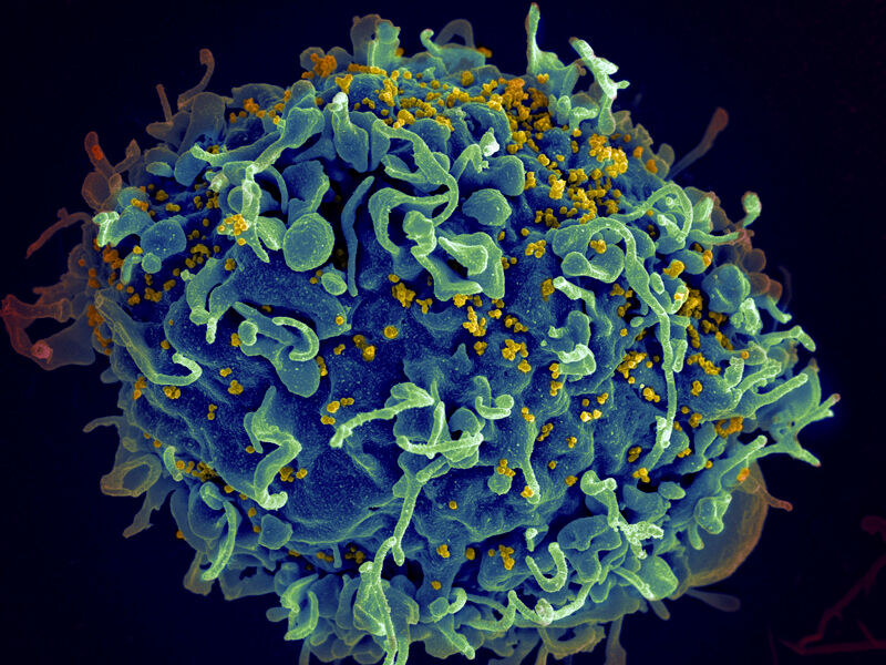 HIV에 공격받는 인간 T세포의 전자현미경 영상 (사진=AP, 연합뉴스)