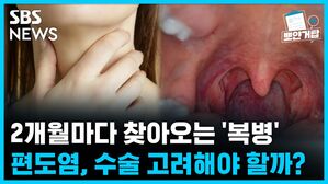 SBS NEWS 뽀얀거탑 의료상담 2개월마다 찾아오는 '복병' 편도염...수술 고려해야 할까?