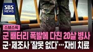군 배터리 폭발에 다친 20살 병사 군&middot;제조사 '잘못 없다'&hellip;자비 치료