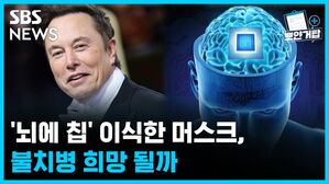 SBS NEWS 뽀얀거탑 '뇌에 칩' 이식한 머스크, 불치병 희망 될까