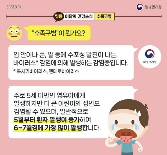 수족구병 (사진=연합뉴스)