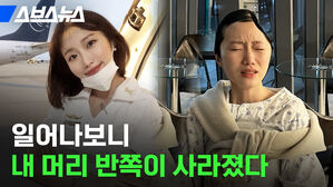 일어나보니 내 머리 반쪽이 사라졌다 스브스뉴스