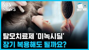 SBS NEWS 뽀얀거탑 의료상담 탈모치료제 '미녹시딜', 장기 복용해도 될까요?