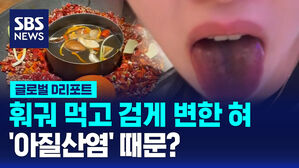 [글로벌D리포트] 훠궈 먹고 검게 변한 혀&hellip;'아질산염' 때문?