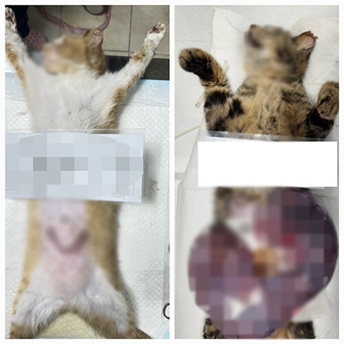 적출된 자궁의 크기 차이