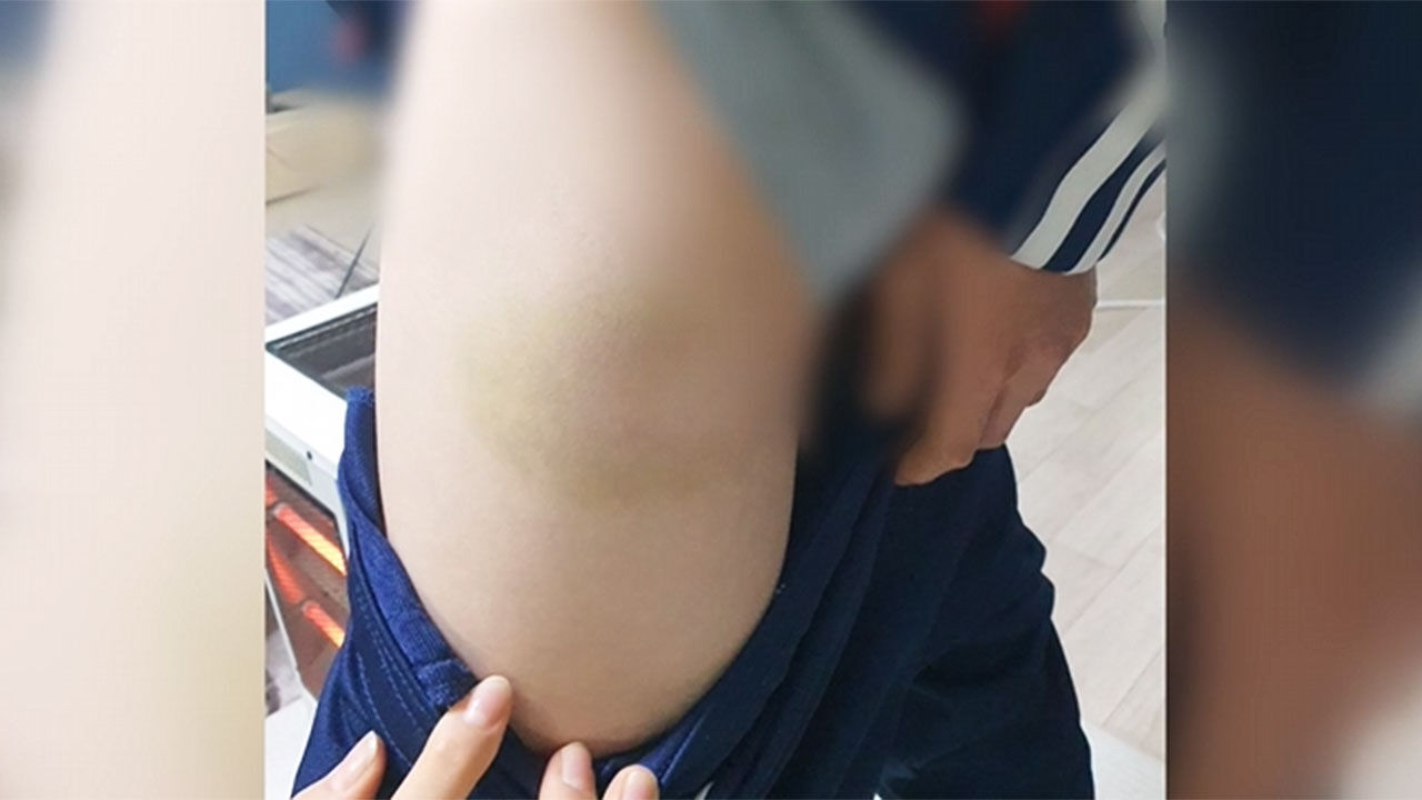 손웅정 감독 아동학대 혐의 피소, 허벅지에 상처 입은 유소년 선수