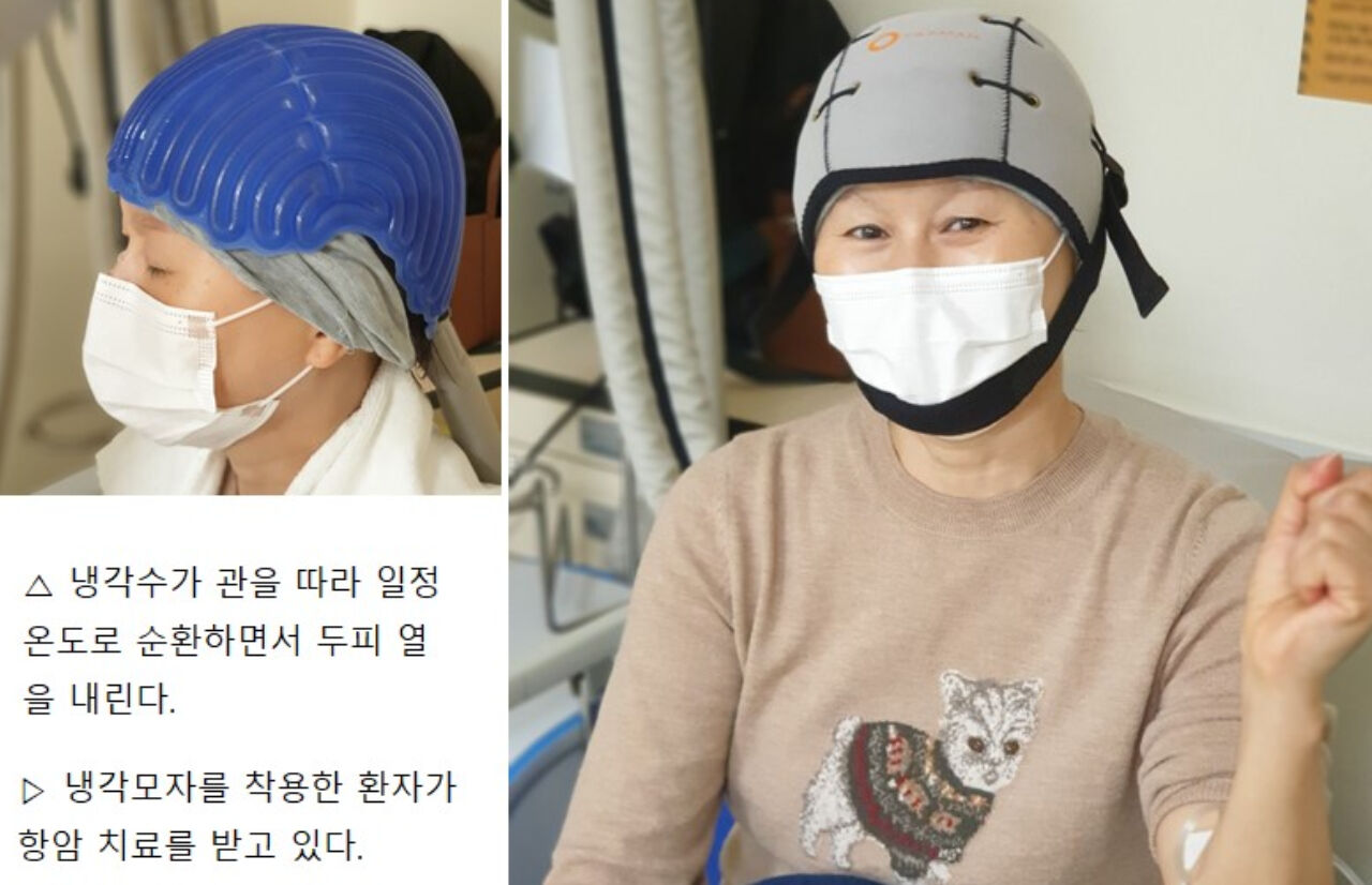 암 환자가 '냉각모자'를 착용한 모습. (사진=삼성서울병원 제공)