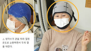 암 환자 탈모 방지하는 '냉각 모자' 효과 입증한 국내 연구진(사진=삼성서울병원 제공)