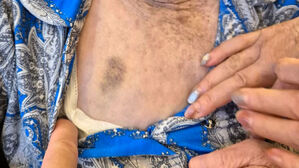 살짝 스쳤는데 "너무 아파"&hellip;목욕하던 엄마 본 딸 분노했다