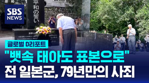 [글로벌D리포트] "뱃속 태아도 표본으로"&hellip;79년 만의 사죄