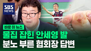 [바로이뉴스] 물집 잡힌 안세영 발&hellip;배드민턴협회장 "어쩔 수 없었다"