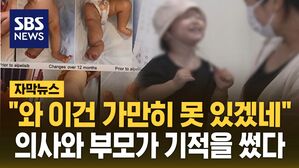 [자막뉴스] "와 이건 가만히 못 있겠네" 의사와 부모가 기적을 썼다