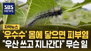 [자막뉴스] '우수수' 몸에 닿으면 피부염&hellip;"우산 쓰고 지나간다" 무슨 일