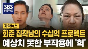 [자막뉴스] 회춘 집착남의 수십억 프로젝트&hellip;예상치 못한 부작용에 '헉'