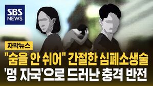 [자막뉴스] "숨을 안 쉬어" 간절한 심폐소생술&hellip;'멍 자국'으로 드러난 진실