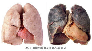 평생 피우고도 건강하다?&hellip;"흡연을 위한 변명일 뿐"