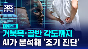 [D리포트] 거북목&middot;골반 각도까지&hellip;AI가 분석해 '조기 진단'