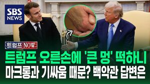 [영상] 트럼프 오른손 '큰 멍 자국'에 소환된 마크롱&hellip;'죽음의 악수'로 불리는 장면들 보니
