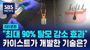 [D리포트] "천연 성분으로 탈모 예방"&hellip;카이스트 개발 기술 화제