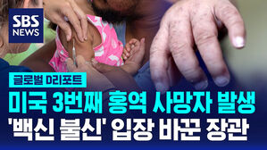 [글로벌D리포트] 미국 3번째 홍역 사망자 발생&hellip;'백신 불신' 입장 바꾼 장관