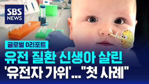 [글로벌D리포트] 유전질환 신생아 살린 '유전자 가위'&hellip;"첫 사례"
