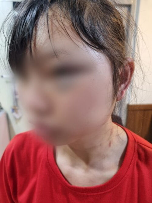 상해 피해를 입은 B 씨 (사진=B 씨 측 제공, 연합뉴스)