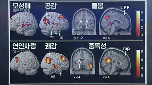 "전 연인 고통이 곧 쾌감" 마약 중독자 뇌처럼 돌변 [이과적 사고]